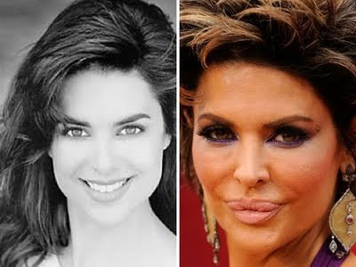 Top Worst Plastic Surgery