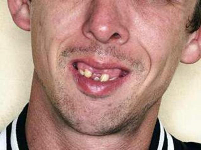 Strange Teeth
