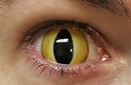 Strange Contact Lenses