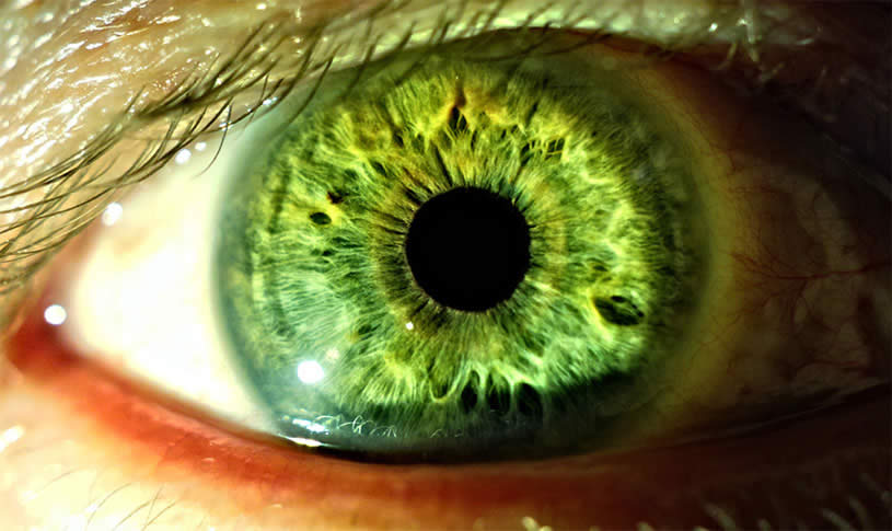 Different Types Of Eye Lenses - XciteFun.net